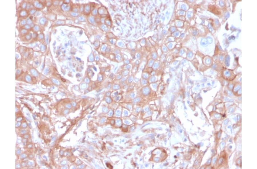 Immunohistochemistry - Anti-CD73 Antibody [NT5E/2505] - BSA and Azide free (A252717) - Antibodies.com