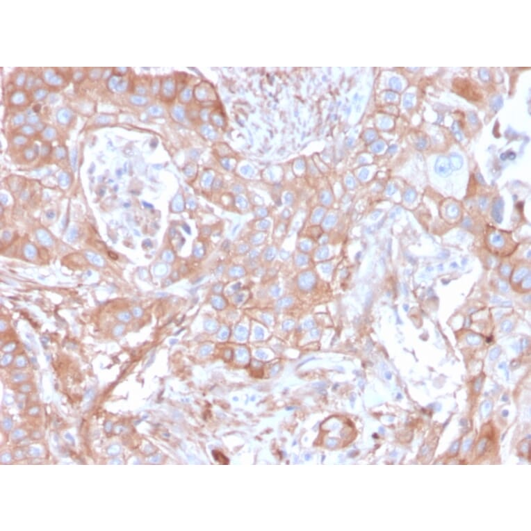 Immunohistochemistry - Anti-CD73 Antibody [NT5E/2505] - BSA and Azide free (A252717) - Antibodies.com