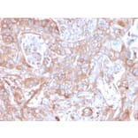 Immunohistochemistry - Anti-CD73 Antibody [NT5E/2505] - BSA and Azide free (A252717) - Antibodies.com