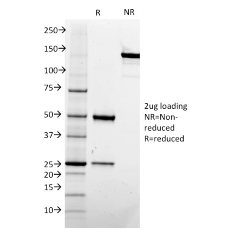 SDS-PAGE - Anti-CD73 Antibody [NT5E/2505] - BSA and Azide free (A252717) - Antibodies.com