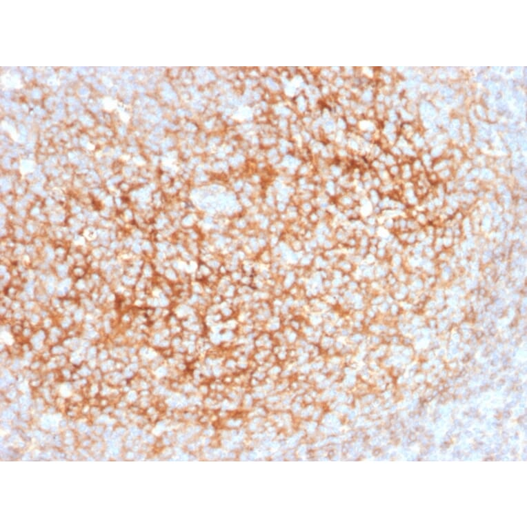 Immunohistochemistry - Anti-CD73 Antibody [NT5E/2545] - BSA and Azide free (A252718) - Antibodies.com