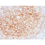 Immunohistochemistry - Anti-CD73 Antibody [NT5E/2545] - BSA and Azide free (A252718) - Antibodies.com