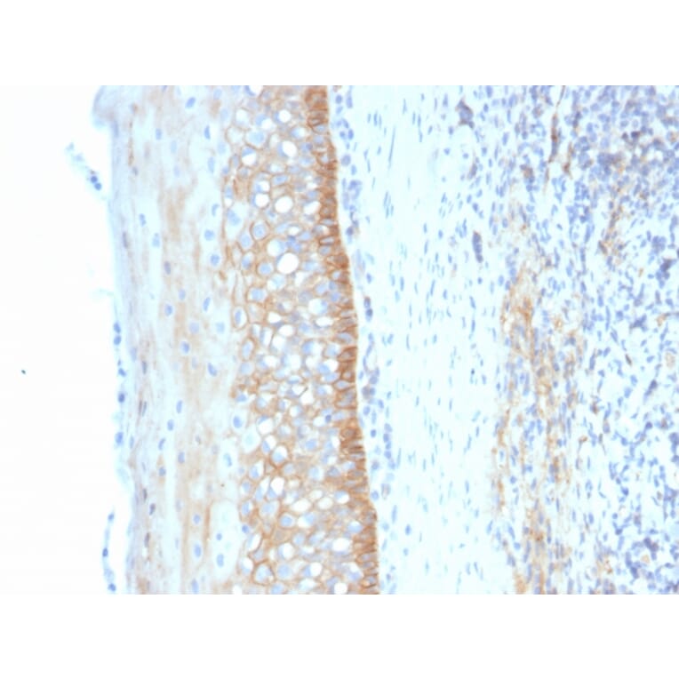 Immunohistochemistry - Anti-CD73 Antibody [NT5E/2545] - BSA and Azide free (A252718) - Antibodies.com