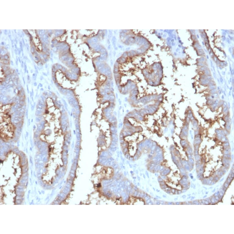 Immunohistochemistry - Anti-CD73 Antibody [NT5E/2545] - BSA and Azide free (A252718) - Antibodies.com