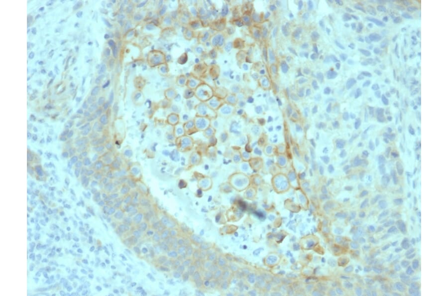 Immunohistochemistry - Anti-CD73 Antibody [NT5E/2545] - BSA and Azide free (A252718) - Antibodies.com