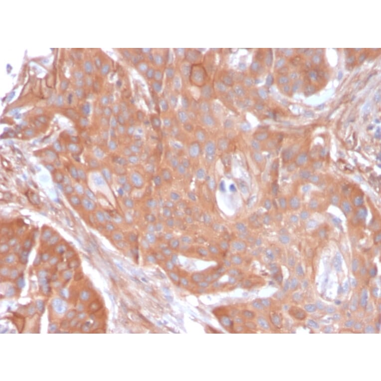 Immunohistochemistry - Anti-CD73 Antibody [NT5E/2545] - BSA and Azide free (A252718) - Antibodies.com