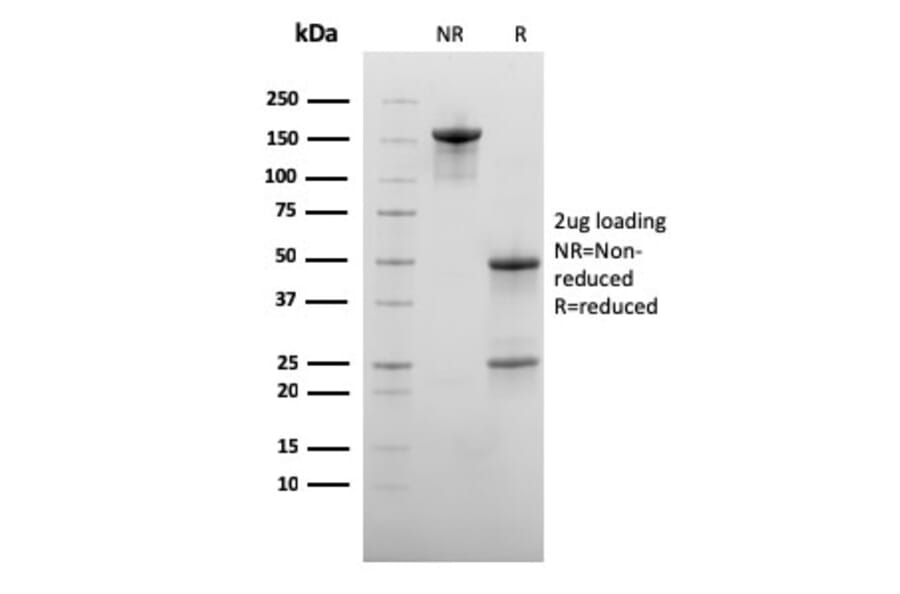 SDS-PAGE - Anti-CD73 Antibody [NT5E/2545] - BSA and Azide free (A252718) - Antibodies.com