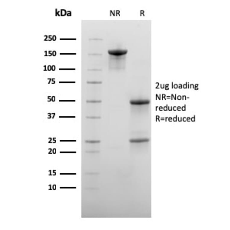 SDS-PAGE - Anti-CD73 Antibody [NT5E/2545] - BSA and Azide free (A252718) - Antibodies.com