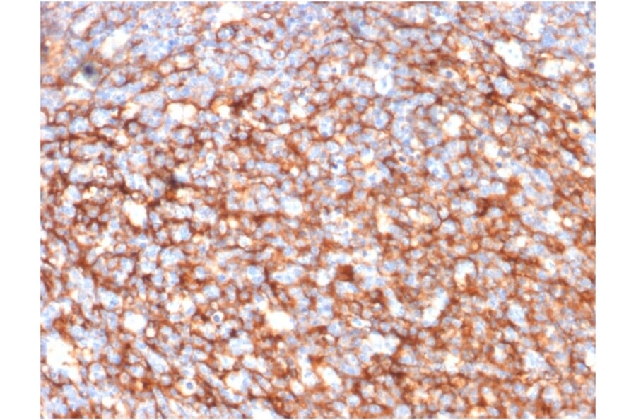 Immunohistochemistry - Anti-CD73 Antibody [NT5E/2646] - BSA and Azide free (A252719) - Antibodies.com