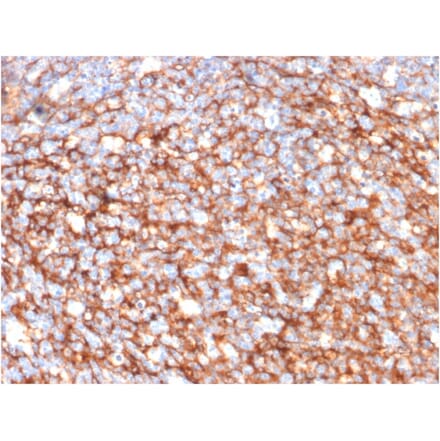 Immunohistochemistry - Anti-CD73 Antibody [NT5E/2646] - BSA and Azide free (A252719) - Antibodies.com