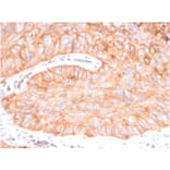 Immunohistochemistry - Anti-CD73 Antibody [NT5E/2646] - BSA and Azide free (A252719) - Antibodies.com