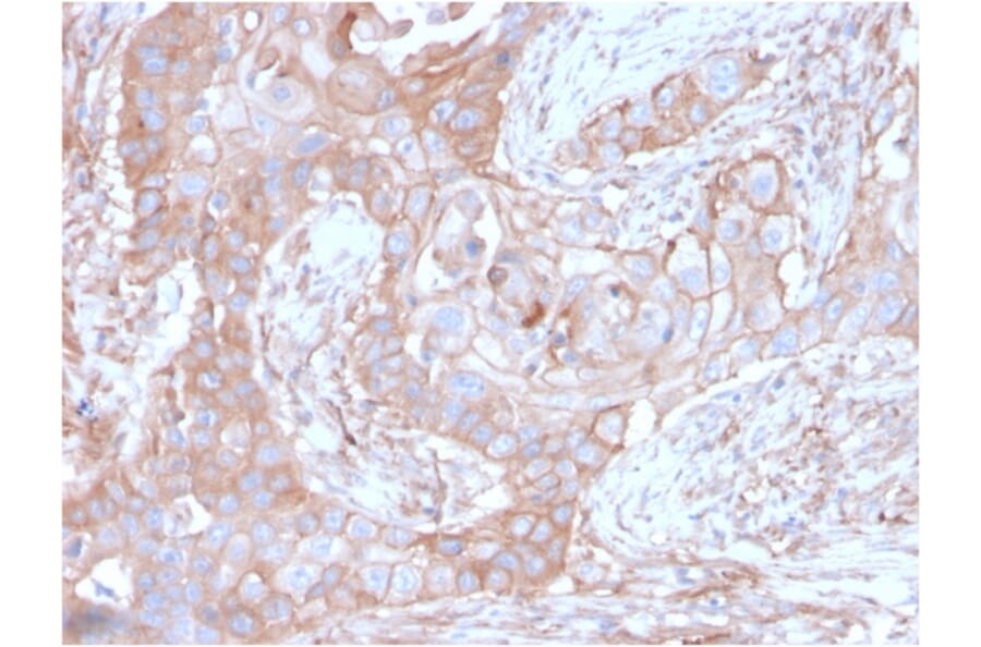 Immunohistochemistry - Anti-CD73 Antibody [NT5E/2646] - BSA and Azide free (A252719) - Antibodies.com