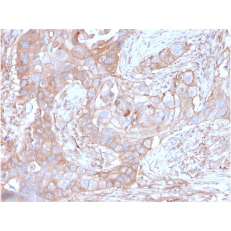 Immunohistochemistry - Anti-CD73 Antibody [NT5E/2646] - BSA and Azide free (A252719) - Antibodies.com