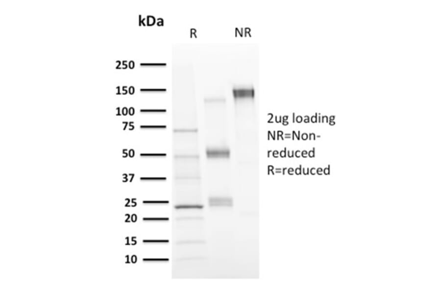 SDS-PAGE - Anti-CD73 Antibody [NT5E/2646] - BSA and Azide free (A252719) - Antibodies.com