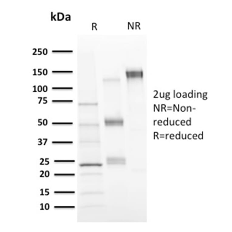 SDS-PAGE - Anti-CD73 Antibody [NT5E/2646] - BSA and Azide free (A252719) - Antibodies.com