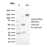 SDS-PAGE - Anti-CD73 Antibody [NT5E/2646] - BSA and Azide free (A252719) - Antibodies.com