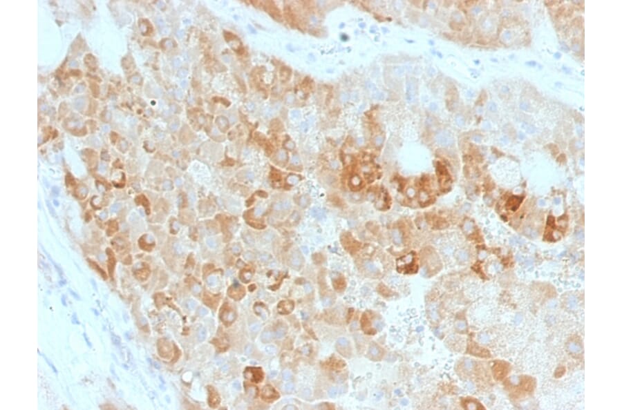 Immunohistochemistry - Anti-ROR2 Antibody [ROR2/1911] - BSA and Azide free (A252719) - Antibodies.com