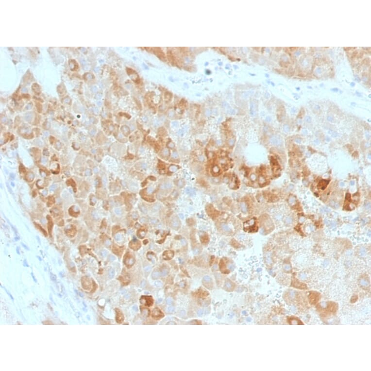 Immunohistochemistry - Anti-ROR2 Antibody [ROR2/1911] - BSA and Azide free (A252719) - Antibodies.com