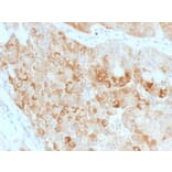 Immunohistochemistry - Anti-ROR2 Antibody [ROR2/1911] - BSA and Azide free (A252719) - Antibodies.com