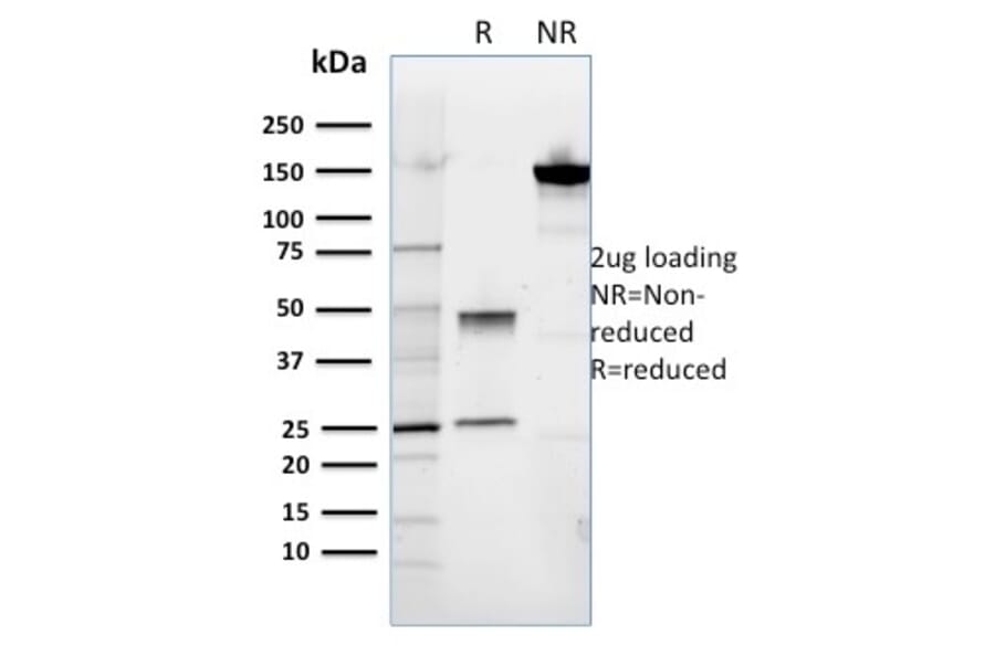 SDS-PAGE - Anti-ROR2 Antibody [ROR2/1911] - BSA and Azide free (A252720) - Antibodies.com