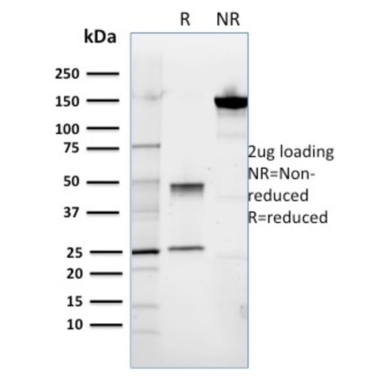 SDS-PAGE - Anti-ROR2 Antibody [ROR2/1911] - BSA and Azide free (A252720) - Antibodies.com