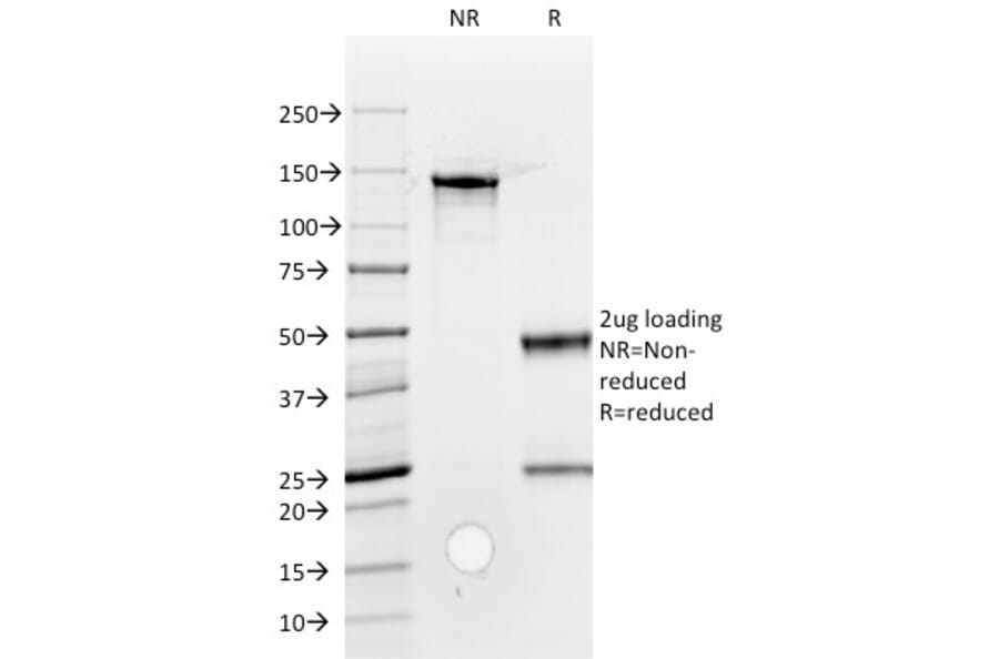 SDS-PAGE - Anti-ROR2 Antibody [ROR2/1912] - BSA and Azide free (A252721) - Antibodies.com