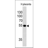 Western Blot - Anti-Ornithine Decarboxylase Antibody [ODC1/485] - BSA and Azide free (A252722) - Antibodies.com