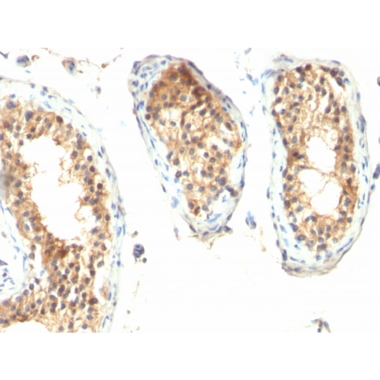 Immunohistochemistry - Anti-Ornithine Decarboxylase Antibody [ODC1/485] - BSA and Azide free (A252722) - Antibodies.com