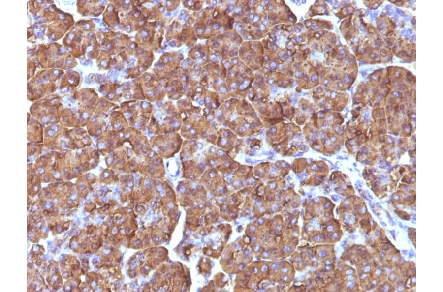 Immunohistochemistry - Anti-Ornithine Decarboxylase Antibody [ODC1/486] - BSA and Azide free (A252723) - Antibodies.com