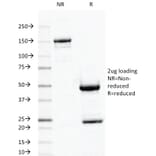 SDS-PAGE - Anti-Ornithine Decarboxylase Antibody [ODC1/487] - BSA and Azide free (A252725) - Antibodies.com