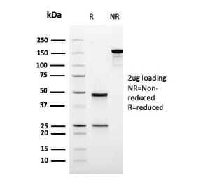 SDS-PAGE - Anti-Ornithine Decarboxylase Antibody [rODC1/485] - BSA and Azide free (A252726) - Antibodies.com