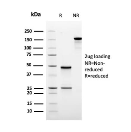 SDS-PAGE - Anti-Ornithine Decarboxylase Antibody [rODC1/485] - BSA and Azide free (A252726) - Antibodies.com