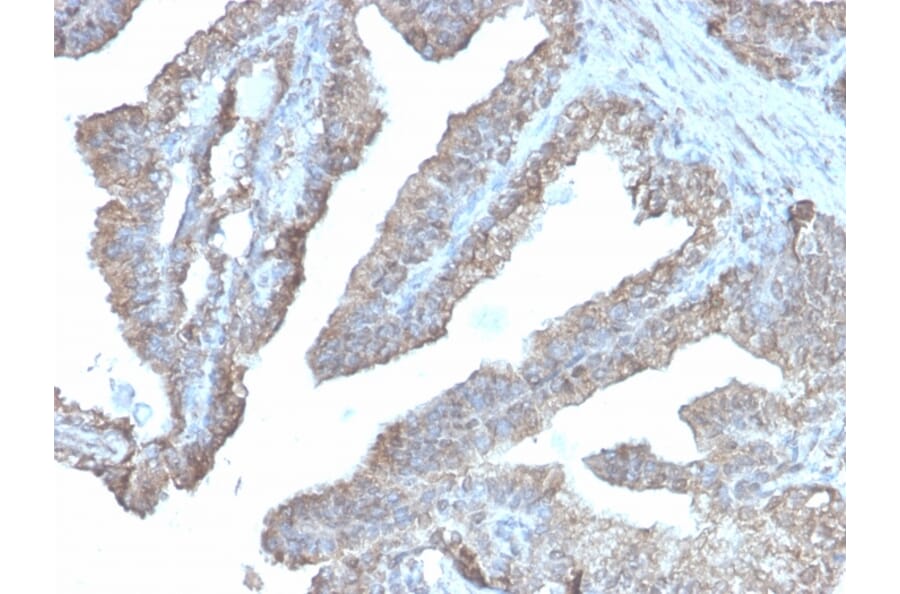 Immunohistochemistry - Anti-Ornithine Decarboxylase Antibody [rODC1/485] - BSA and Azide free (A252725) - Antibodies.com