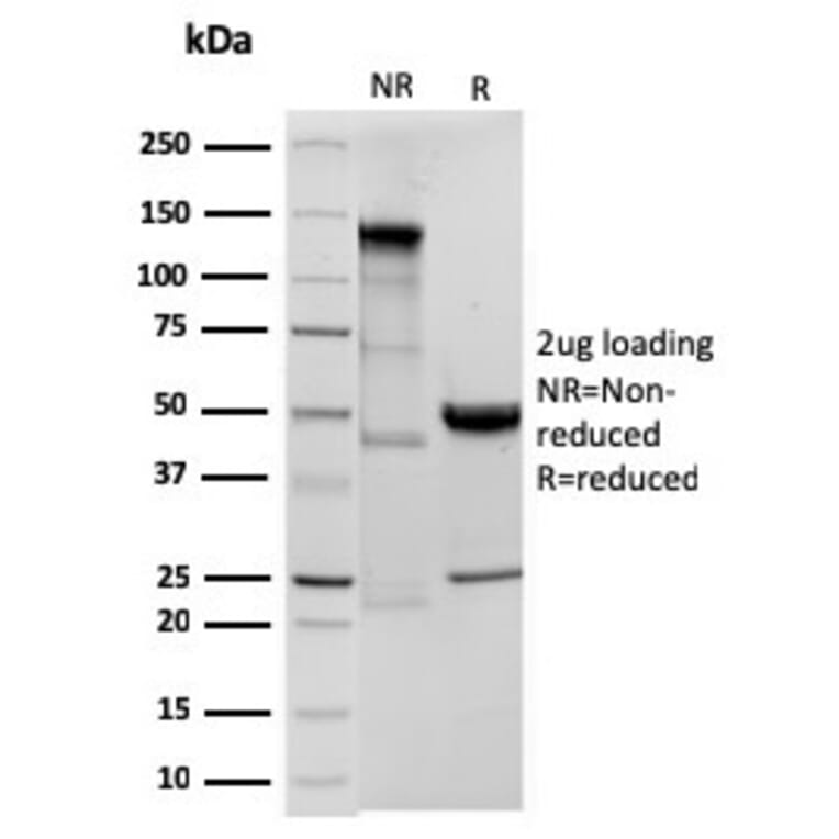 SDS-PAGE - Anti-Ornithine Decarboxylase Antibody [ODC1/3636R] - BSA and Azide free (A252728) - Antibodies.com