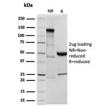 SDS-PAGE - Anti-Ornithine Decarboxylase Antibody [ODC1/3636R] - BSA and Azide free (A252728) - Antibodies.com