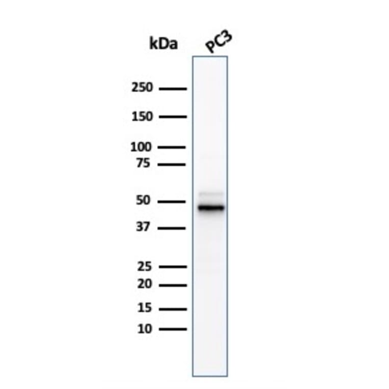 Western Blot - Anti-Ornithine Decarboxylase Antibody [ODC1/3636R] - BSA and Azide free (A252728) - Antibodies.com