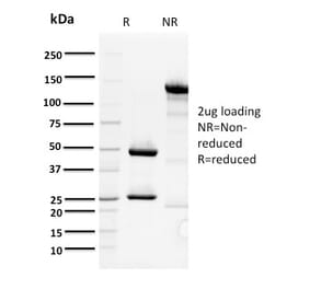 SDS-PAGE - Anti-ORC1 Antibody [7F6/1] - BSA and Azide free (A252729) - Antibodies.com