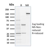 SDS-PAGE - Anti-Langerin Antibody [LGRN/1821] - BSA and Azide free (A252731) - Antibodies.com