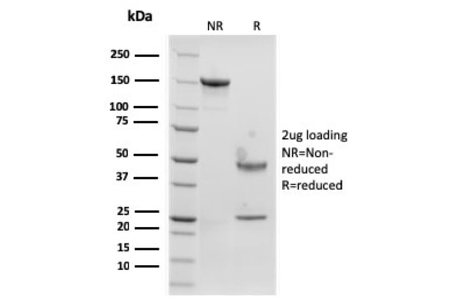 SDS-PAGE - Anti-Langerin Antibody [rLGRN/1821] - BSA and Azide free (A252731) - Antibodies.com