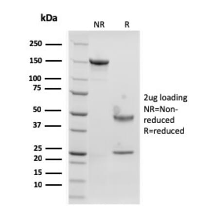 SDS-PAGE - Anti-Langerin Antibody [rLGRN/1821] - BSA and Azide free (A252731) - Antibodies.com