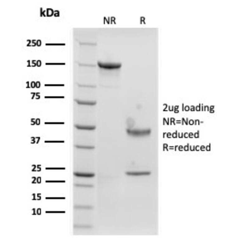 SDS-PAGE - Anti-Langerin Antibody [rLGRN/1821] - BSA and Azide free (A252731) - Antibodies.com