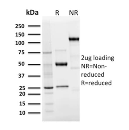 SDS-PAGE - Anti-Langerin Antibody [LGRN/3136R] - BSA and Azide free (A252732) - Antibodies.com