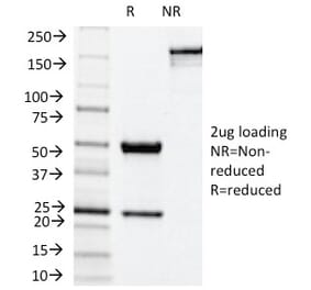 SDS-PAGE - Anti-NADPH Oxidase 4 Antibody [NOX4/1245] - BSA and Azide free (A252733) - Antibodies.com