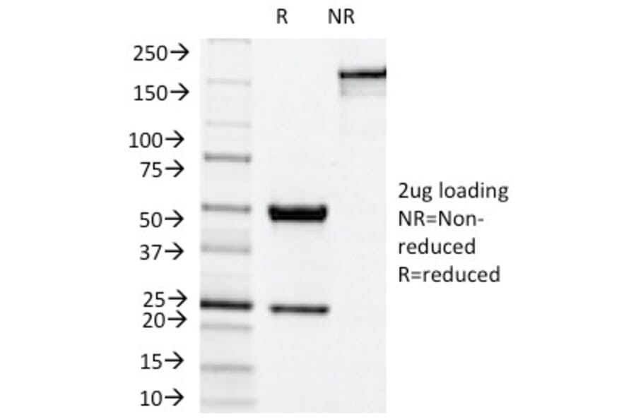 SDS-PAGE - Anti-NADPH Oxidase 4 Antibody [NOX4/1245] - BSA and Azide free (A252733) - Antibodies.com