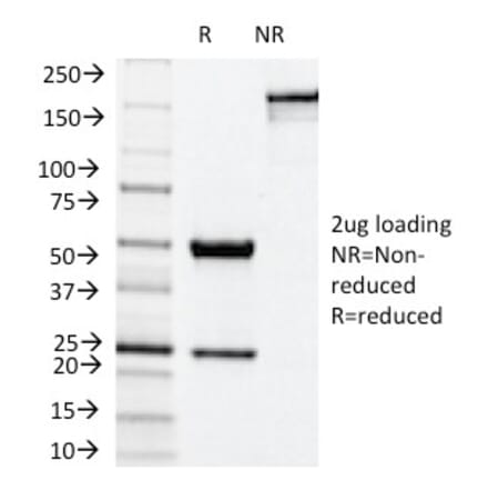 SDS-PAGE - Anti-NADPH Oxidase 4 Antibody [NOX4/1245] - BSA and Azide free (A252733) - Antibodies.com