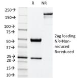 SDS-PAGE - Anti-NADPH Oxidase 4 Antibody [NOX4/1245] - BSA and Azide free (A252733) - Antibodies.com