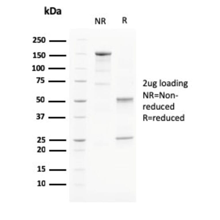 SDS-PAGE - Anti-PAPP A Antibody [PAPPA/2715] - BSA and Azide free (A252735) - Antibodies.com
