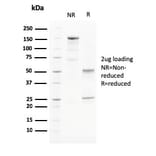 SDS-PAGE - Anti-PAPP A Antibody [PAPPA/2715] - BSA and Azide free (A252735) - Antibodies.com