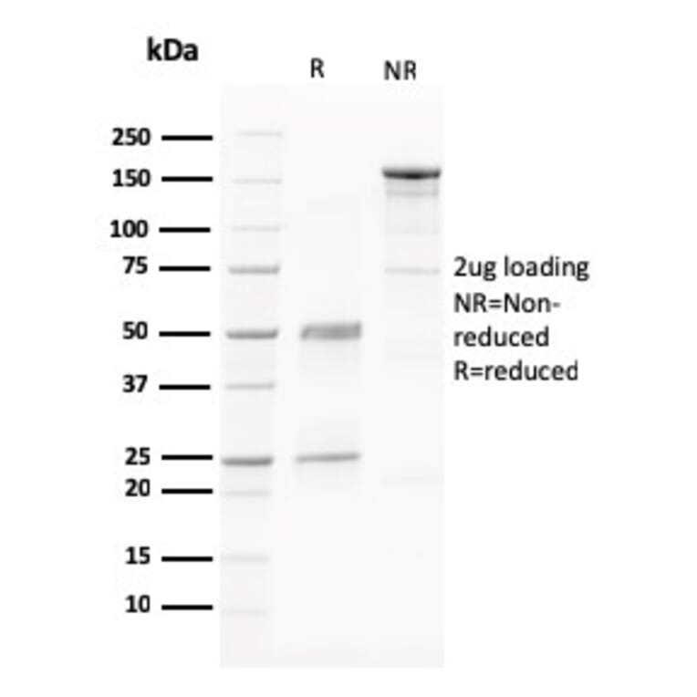 SDS-PAGE - Anti-PAPP A Antibody [PAPPA/2716] - BSA and Azide free (A252736) - Antibodies.com