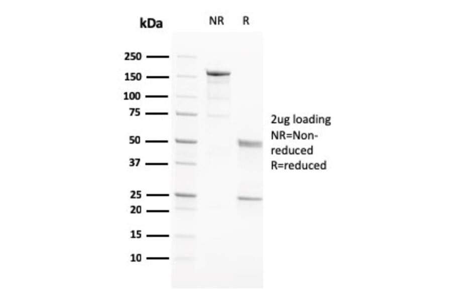 SDS-PAGE - Anti-PAPP A Antibody [PAPPA/2717] - BSA and Azide free (A252737) - Antibodies.com